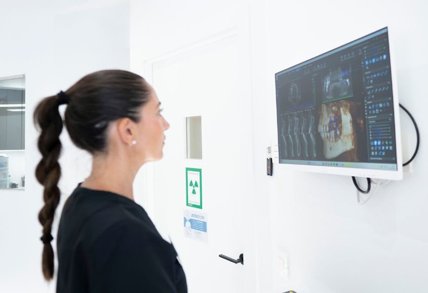 implantes-dentales-rehabilitacion-completa-madrid-excelentia