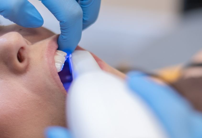 estetica-dental-en-ciudad-lineal-tecnologia-escaner