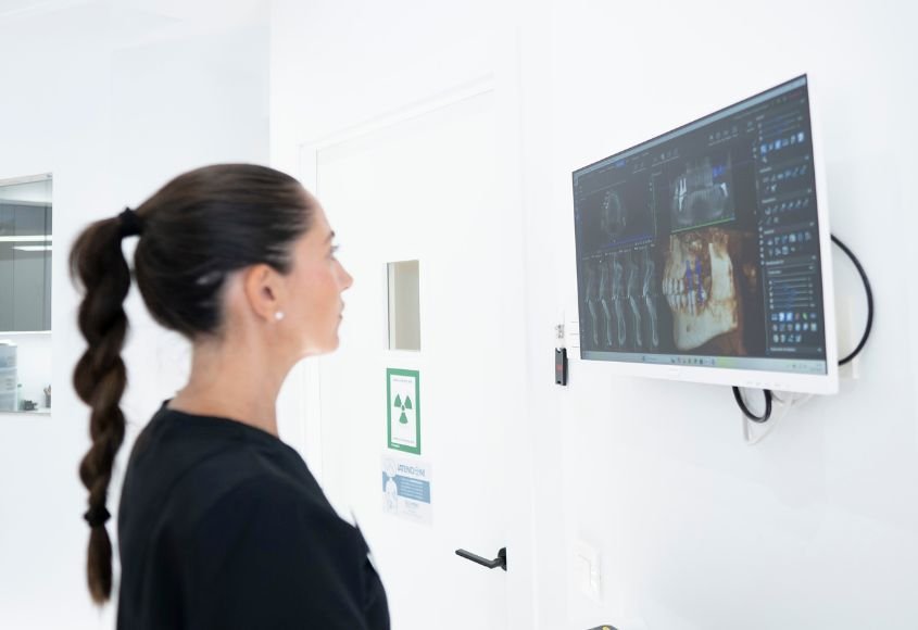 implantes-dentales-zigomaticos-ciudad-lineal-madrid