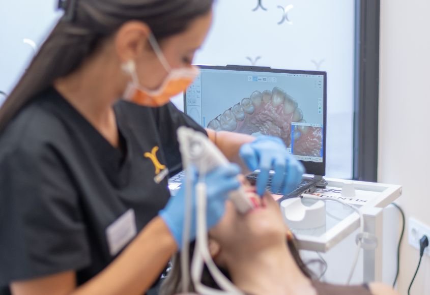 ortodoncia-tecnologia-escaner-intraoral-ciudad-lineal-madrid