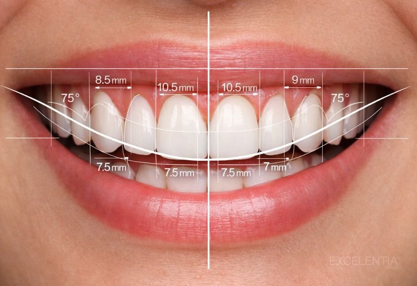 diseño-digital-de-sonrisa-dsd-en-ciudad-lineal