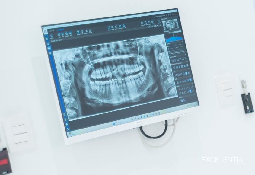 panoramica-dental-clinica-excelentia-ciudad-lineal