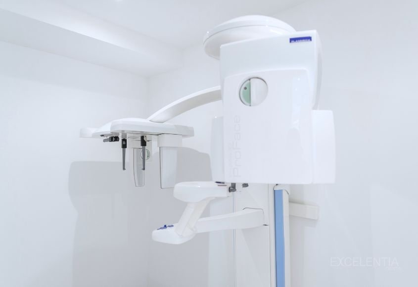 radiologia-dental-tac-3d-cbct